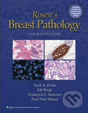 Rosen's Breast Pathology (Fourth edition) - Syed A. Hoda, Edi Brogi, Frederick C. Koerner, Paul Peter Rosen - kniha z kategorie Odborné a naučné