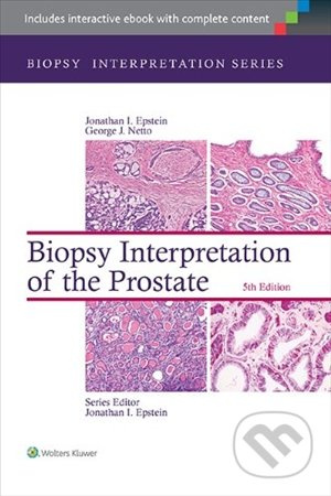 Biopsy Interpretation of the Liver - Michael Torbenson - kniha z kategorie Odborné a naučné