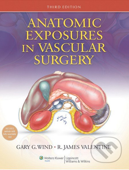 Anatomic Exposures in Vascular Surgery (3e) - Gary G. Wind, R. James Valentine - kniha z kategorie Odborné a naučné