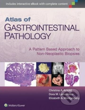 Atlas of Gastrointestinal Pathology (A Pattern Based Approach to Non-Neoplastic) - kniha z kategorie Medicína