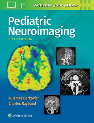 Pediatric Neuroimaging Lippincott Williams and Wilkins