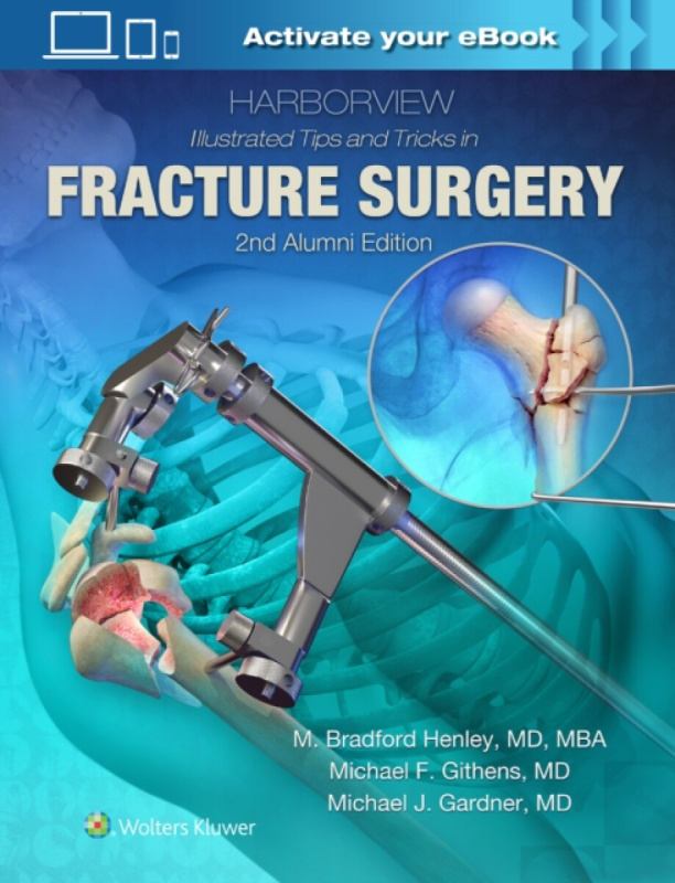 Harborview Illustrated Tips and Tricks in Fracture Surgery - M. Bradford Henley, Michael F. Githens, Michael J. Gardner