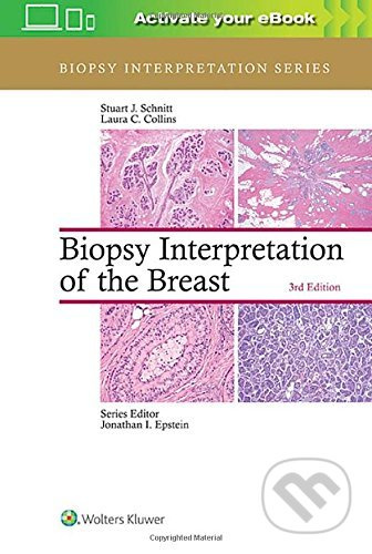 Biopsy Interpretation of the Breast (Third Edition) - kniha z kategorie Medicína