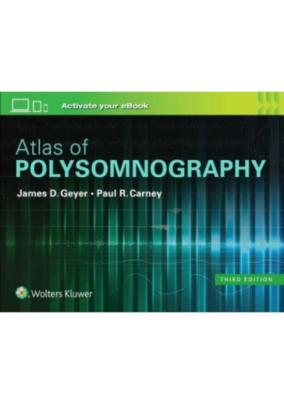 Atlas of Polysomnography Lippincott Williams and Wilkins