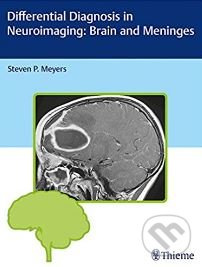 Differential Diagnosis in Neuroimaging (Brain and Meninges) - kniha z kategorie Medicína