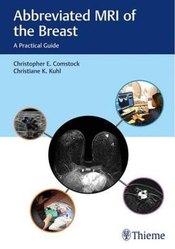 Abbreviated MRI of the Breast, A Practical Guide Thieme Medical Publishers Inc