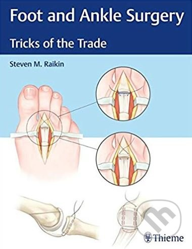 Foot and Ankle Surgery - Steven Raikin - kniha z kategorie Medicína