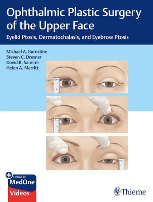 Ophthalmic Plastic Surgery of the Upper Face, Eyelid Ptosis, Dermatochalasis, and Eyebrow Ptosis Thieme Medical Publishers Inc