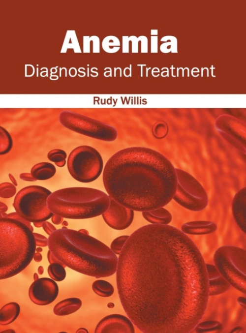 Hayle Medical Anemia: Diagnosis and Treatment