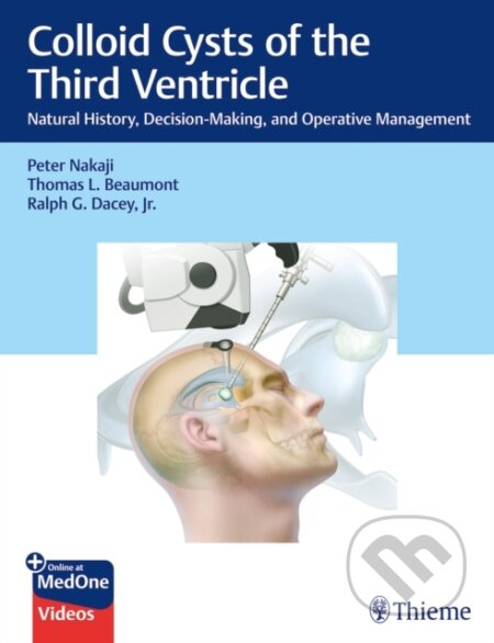 Colloid Cysts of the Third Ventricle (Natural History, Decision-Making, and Operative Management) - kniha z kategorie Medicína