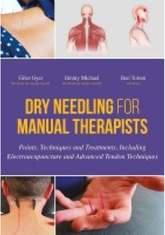 Dry Needling for Manual Therapists, Points, Techniques and Treatments, Including Electroacupuncture and Advanced Tendon Techniques Jessica Kingsley Publishers