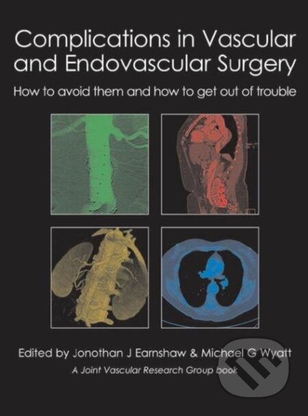 Complications in Vascular and Endovascular Surgery - kniha z kategorie Chirurgie