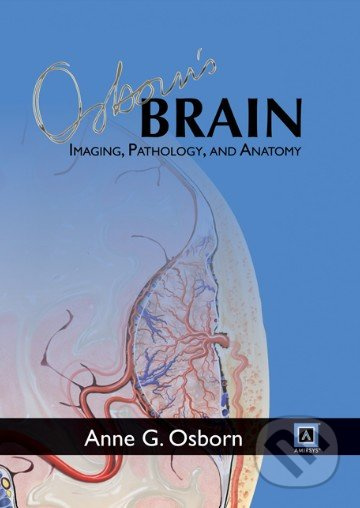 Osborn's Brain: Imaging, Pathology, and Anatomy - Anne G. Osborn - kniha z kategorie Odborné a naučné