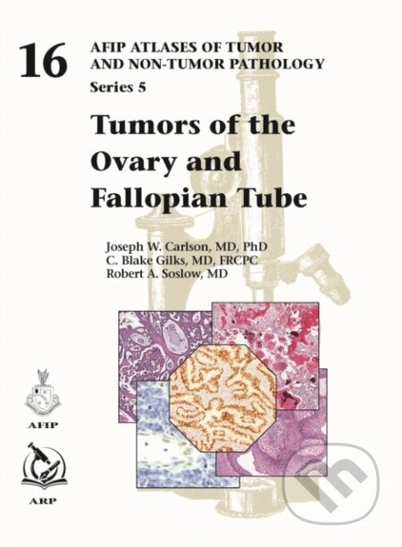 Tumors of the Ovary and Fallopian Tube - C. Blake Gilks, Joseph W. Carlson, Robert A. Soslow - kniha z kategorie Onkologie