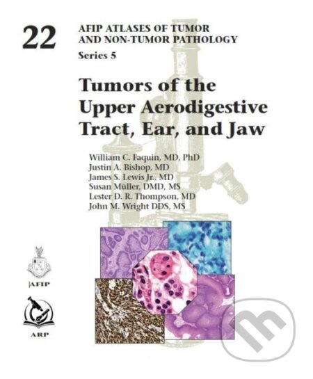 Tumors of the Upper Aerodigestive Tract, Ear, and Jaw - kniha z kategorie Onkologie