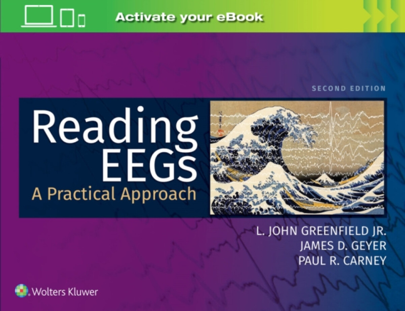Reading EEGs: A Practical Approach - James D., MD Geyer, Paul R., MD, DABSM Carney, L. John, Jr., MD, PhD Greenfield