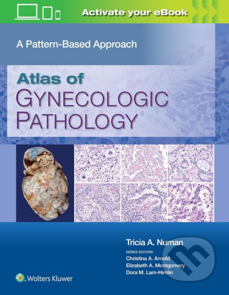 Atlas of Gynecologic Pathology (A Pattern-Based Approach) - kniha z kategorie Gynekologie
