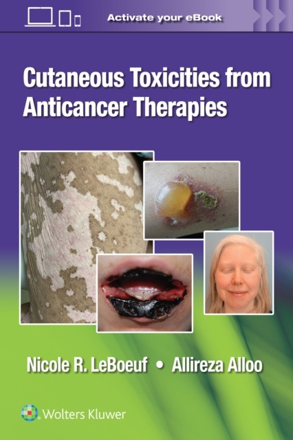 Cutaneous Reactions from Anti-Cancer Therapies Wolters Kluwer Health