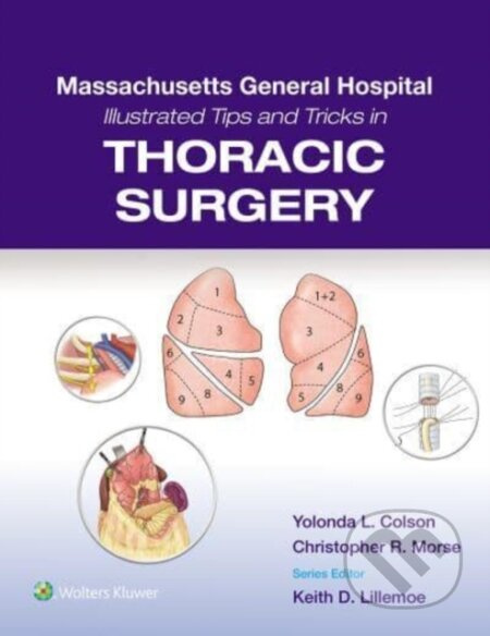 Massachusetts General Hospital Illustrated Tips and Tricks in Thoracic Surgery - kniha z kategorie Chirurgie