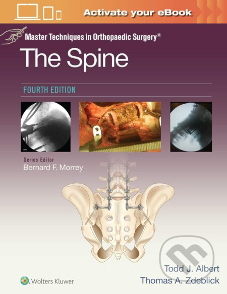 Master Techniques in Orthopaedic Surgery: The Spine - kniha z kategorie Chirurgie