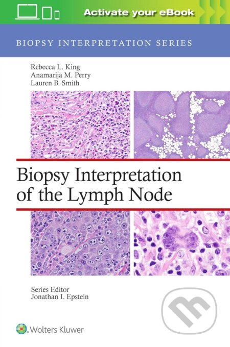 Biopsy Interpretation of the Lymph Node - Anamarija M. Perry, Lauren B. Smith, Rebecca Leigh King - kniha z kategorie Medicína