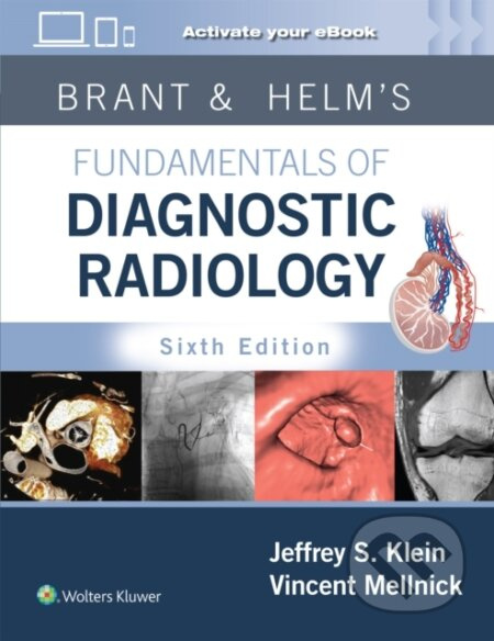 Brant And Helms Fundamentals Of Diagnos - Jeffrey, MD, FACR Klein, Vincent Mellnick - kniha z kategorie