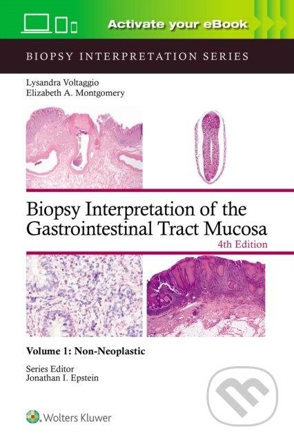 Biopsy Interpretation of the Gastrointestinal Tract Mucosa Volume 1 - kniha z kategorie Medicína