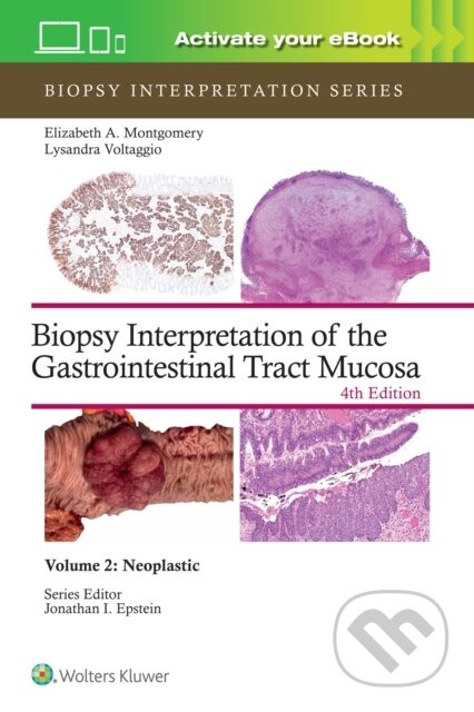 Biopsy Interpretation of the Gastrointestinal Tract Mucosa Volume 2 : Neoplastic - kniha z kategorie Onkologie