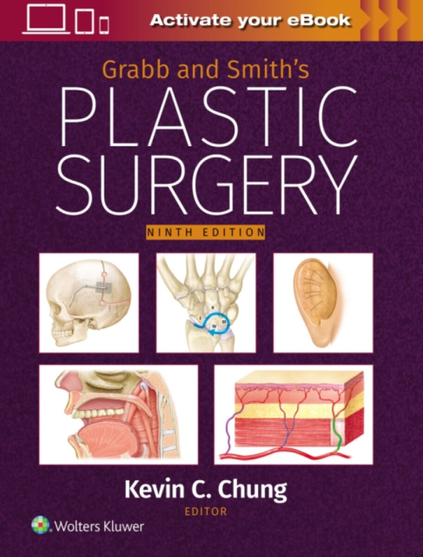 Grabb and Smiths Plastic Surgery: Print + eBook with Multimedia Wolters Kluwer Health