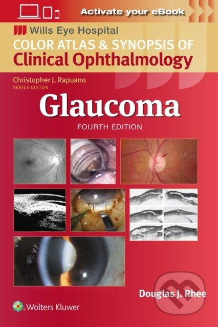Glaucoma: Wills Eye Institute Atlas Series - Douglas J. Rhee - kniha z kategorie Medicína
