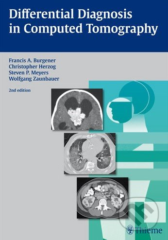 Differential Diagnosis in Computed Tomography - Francis A. Burgener - kniha z kategorie Odborné a naučné