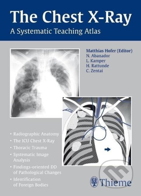 Chest X-ray Trainer - Matthias Hofer - kniha z kategorie Medicína