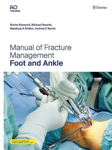 Manual of Fracture Management - Foot and Ankle Thieme Publishing Group