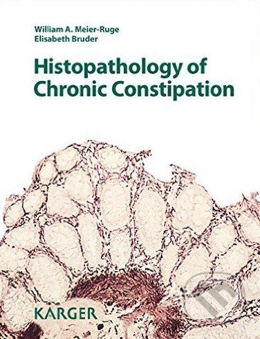Histopathology of Chronic Constipation - Elisabeth Bruder a kol. - kniha z kategorie Medicína