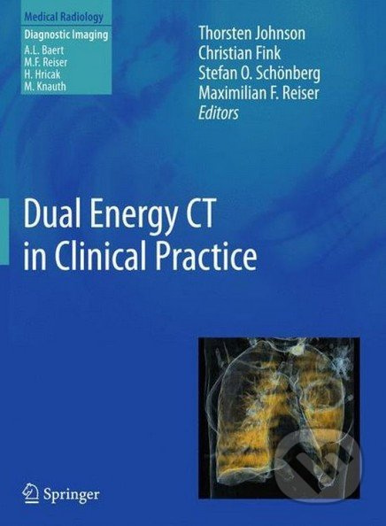 Dual Energy CT in Clinical Practice - Thorsten Johnson a kol. - kniha z kategorie Medicína