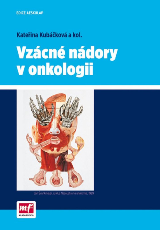 Vzácné nádory v onkologii - Kateřina Kubáčková - kniha z kategorie Onkologie