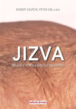 Jizva nejen v popáleninové medicíně - Robert Zajíček, kol., Peter Gál