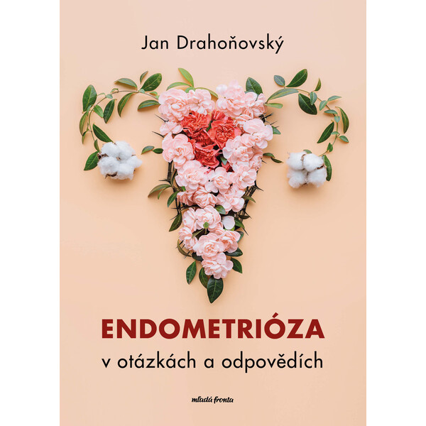 Endometrióza v otázkách a odpovědích - Jan Drahoňovský, Misha Lebeda