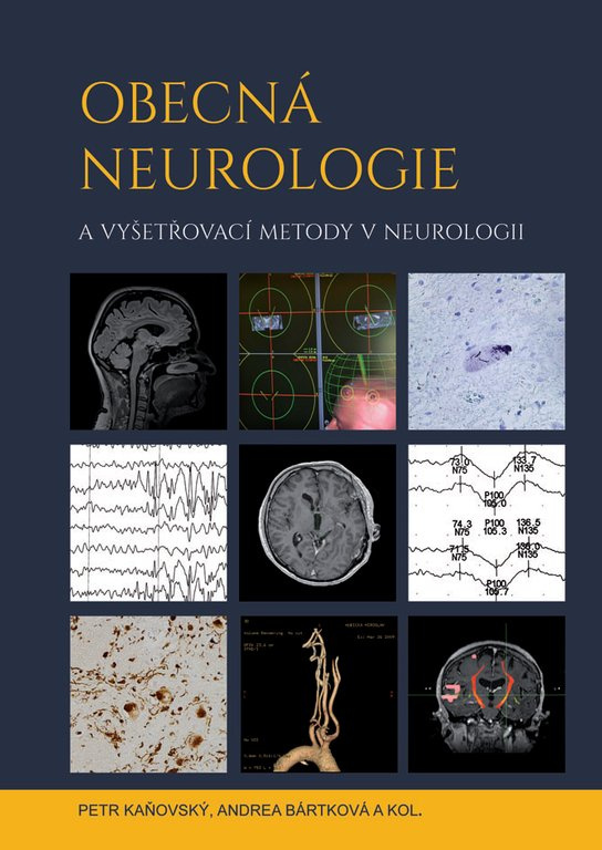 Obecná neurologie a vyšetřovací metody v neurologii -  Andrea Bártková
