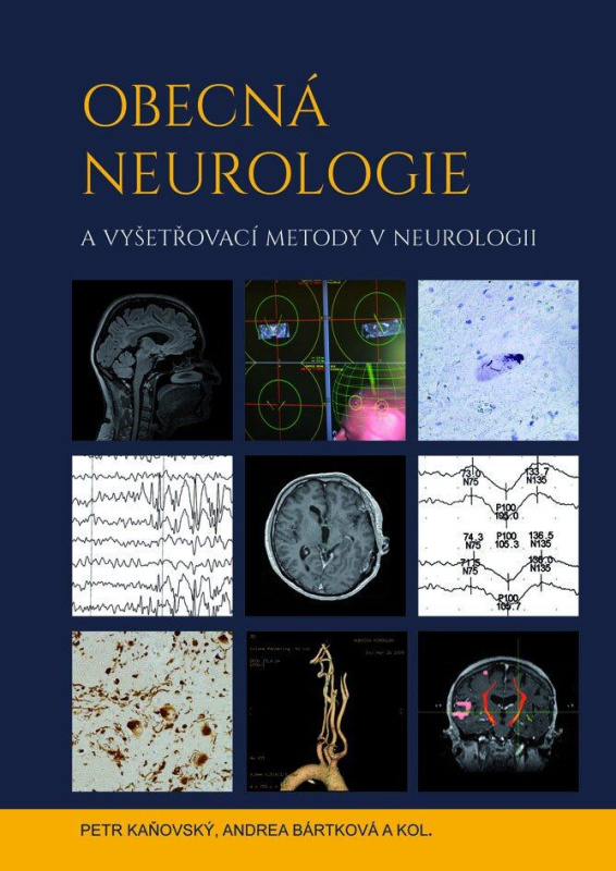 Obecná neurologie a vyšetřovací metody v neurologii - kniha z kategorie Neurologie