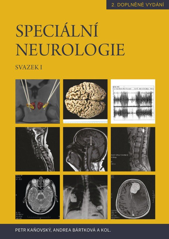Speciální neurologie (2 svazky) (2. doplněné vydání) - kniha z kategorie Medicína