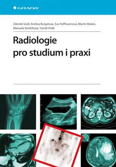 Radiologie pro studium i praxi - Zdeněk Seidl, Andrea Burgetová, Eva Hoffmannová, Martin Mašek, Manuela Vaněčková, Tomáš Viták