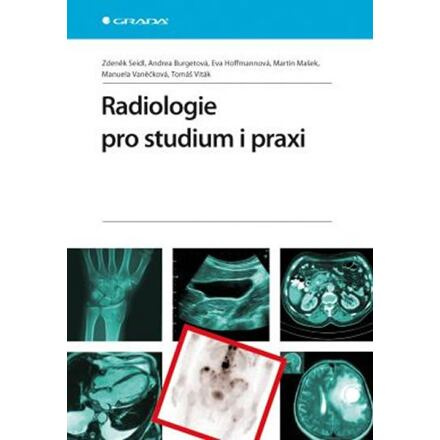 Radiologie pro studium i praxi - Zdeněk Seidl, Andrea Burgetová, Eva Hoffmannová, Martin Mašek, Manuela Vaněčková, Tomáš Viták