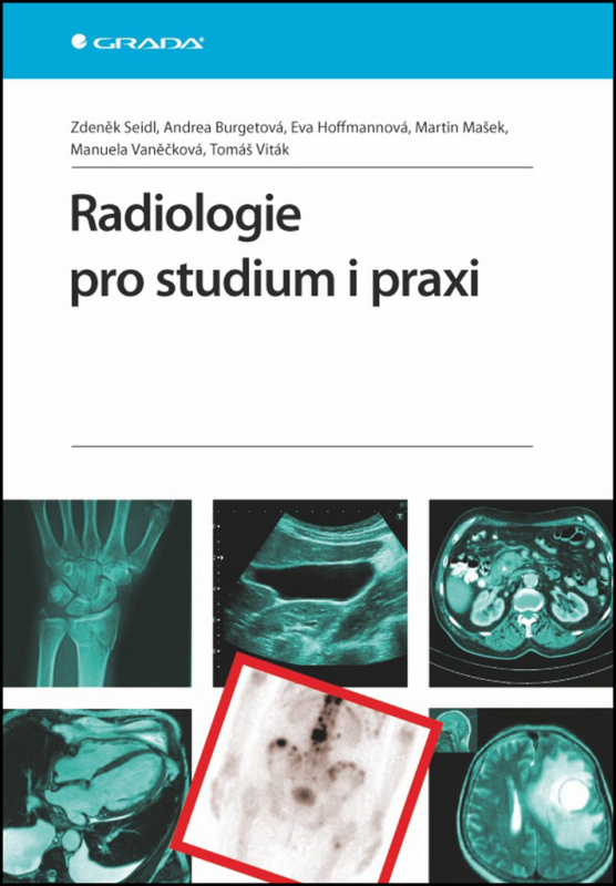 Radiologie pro studium i praxi - Zdeněk Seidl, Andrea Burgetová, Eva Hoffmannová, Martin Mašek, Manuela Vaněčková, Tomáš Viták