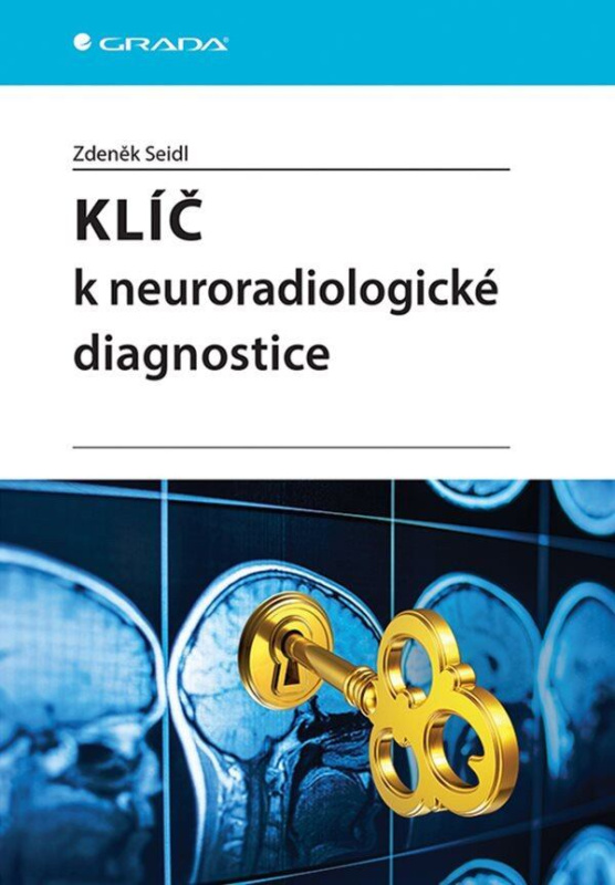 Kniha: Klíč k neuroradiologické diagnostice od Seidl Zdeněk