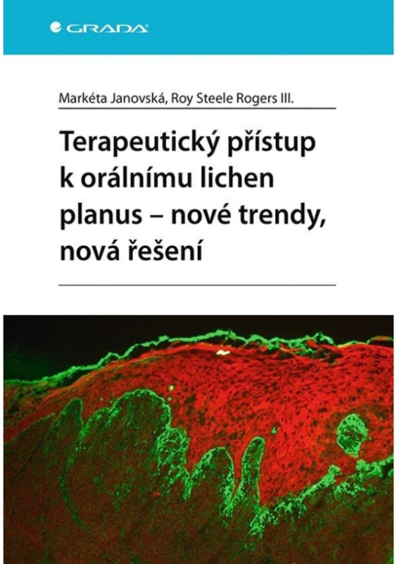 Terapeutický přístup k orálnímu lichen planus - Markéta Janovská, Roy Steele Rogers III.