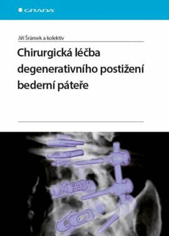 Kniha: Chirurgická léčba degenerativního postižení bederní páteře od Šrámek Jiří