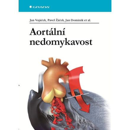 Aortální nedomykavost