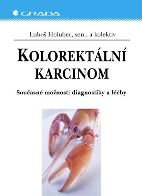 E-kniha: Kolorektální karcinom od Holubec Luboš