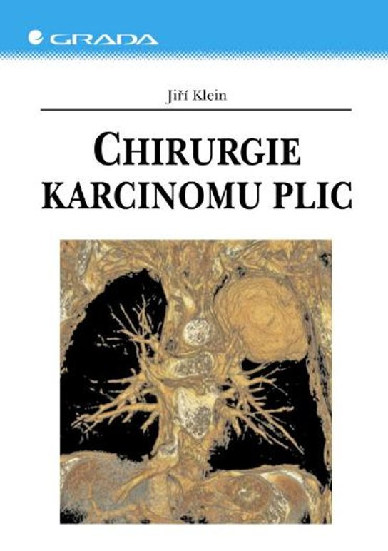 E-kniha: Chirurgie karcinomu plic od Klein Jiří